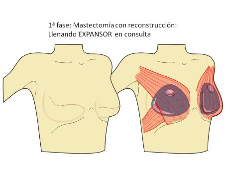 Diapositiva3