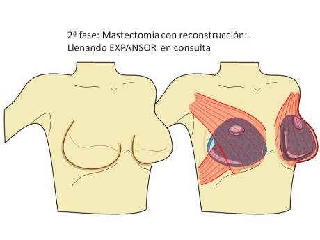 Diapositiva4
