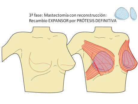 Diapositiva5